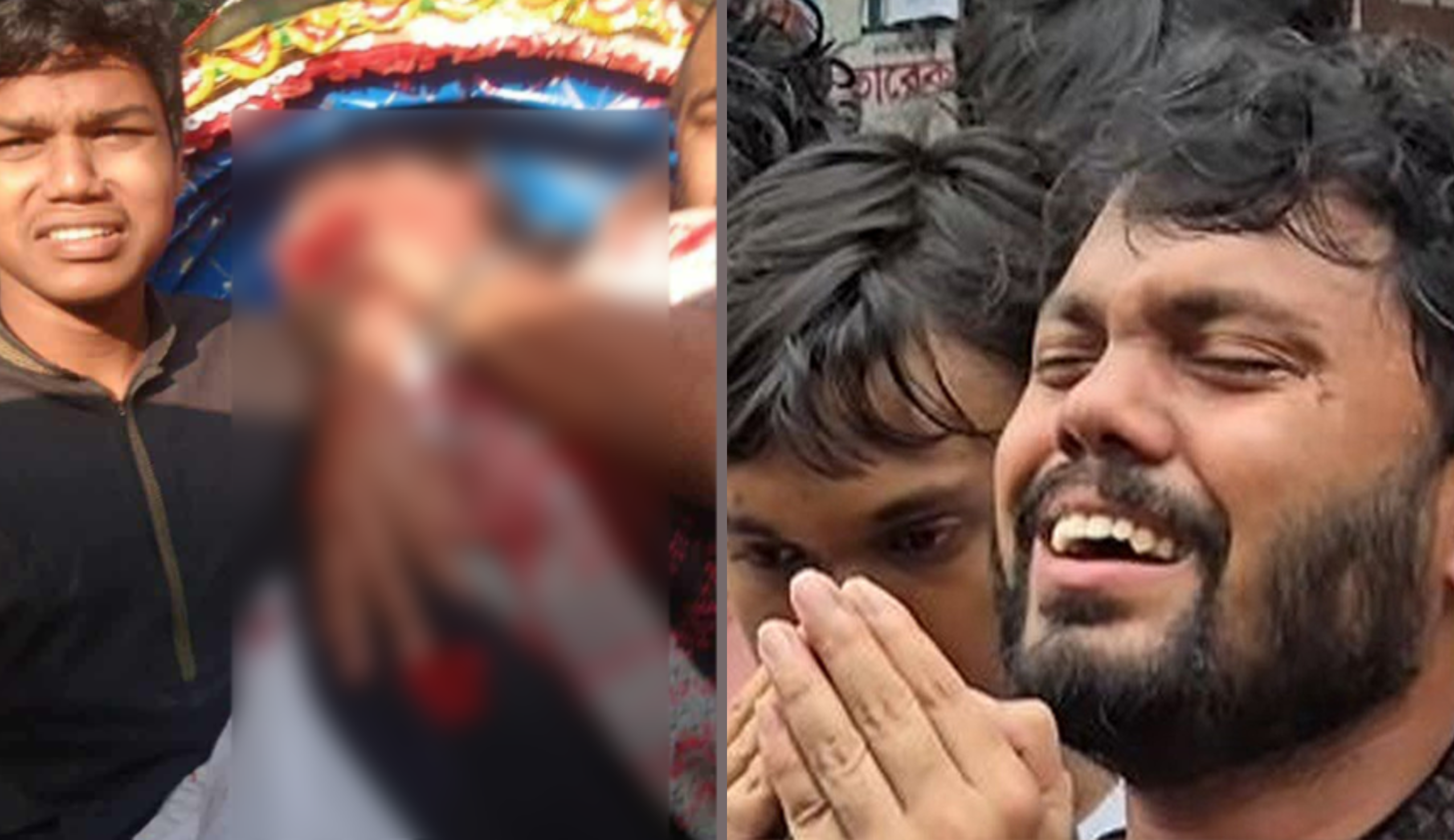 হাদির জরুরি অস্ত্রোপচার, অবস্থা আশঙ্কাজনক